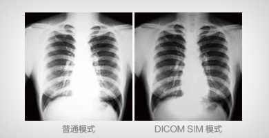 DICOM SIM模式 - Epson CB-G7800產(chǎn)品功能